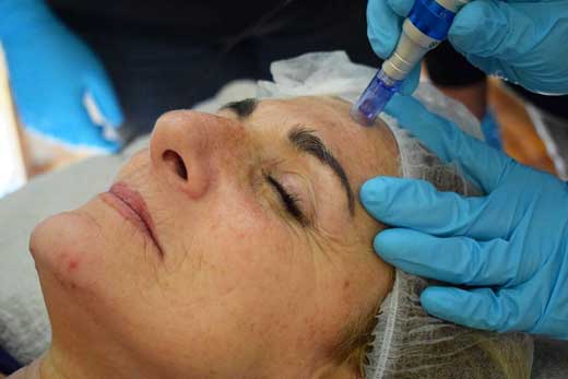 Curso Superior de Envejecimiento Facial