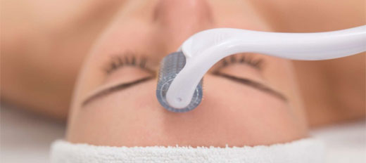 Combinaciones de Activos para Microneedling