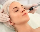 Curso prctico presencial de microneedling, con opcin online en vivo